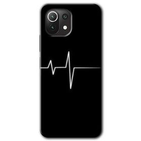 Xiaomi Mi 11 Heart Rytm Baskılı Uyumlu Silikon Kılıf