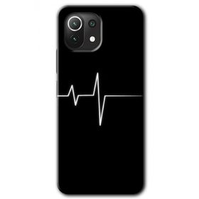 Xiaomi Mi 11 Heart Rytm Baskılı Uyumlu Silikon Kılıf