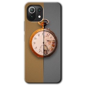 Xiaomi Mi 11 Lite Hd Desen Baskılı Clocks Artwork Arka Kapak Kılıf