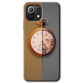 Xiaomi Mi 11 Lite Hd Desen Baskılı Clocks Artwork Arka Kapak Kılıf