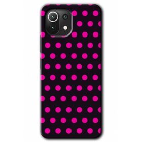 Xiaomi Mi 11 Lite Hd Desen Baskılı Exlusive Design 4 Arka Kapak Kılıf