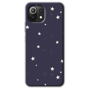 Xiaomi Mi 11 Lite Hd Desen Baskılı Gökyüzü Yıldız Arka Kapak Kılıf