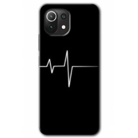 Xiaomi Mi 11 Lite Hd Desen Baskılı Heart Rytm Arka Kapak Kılıf