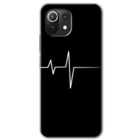 Xiaomi Mi 11 Lite Hd Desen Baskılı Heart Rytm Arka Kapak Kılıf