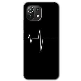Xiaomi Mi 11 Lite Hd Desen Baskılı Heart Rytm Arka Kapak Kılıf