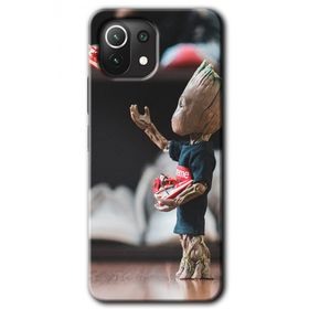 Xiaomi Mi 11 Lite Hd Desen Baskılı I Am Groot Arka Kapak Kılıf