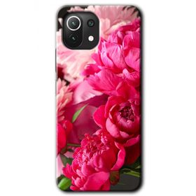 Xiaomi Mi 11 Lite Hd Desen Baskılı Kırmızı Beyaz Gül Arka Kapak Kılıf