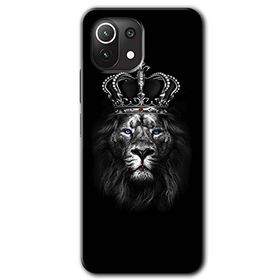 Xiaomi Mi 11 Lite Hd Desen Baskılı Lion King Arka Kapak Kılıf