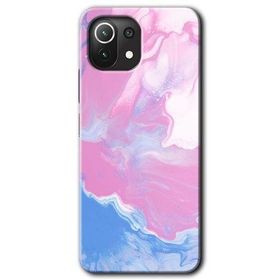 Xiaomi Mi 11 Lite Hd Desen Baskılı Liquid Lekeler Art Arka Kapak Kılıf
