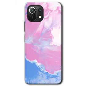 Xiaomi Mi 11 Lite Hd Desen Baskılı Liquid Lekeler Art Arka Kapak Kılıf