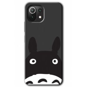 Xiaomi Mi 11 Lite Hd Desen Baskılı Şaşkın Eşek Arka Kapak Kılıf