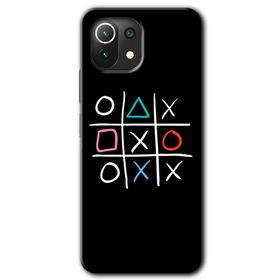 Xiaomi Mi 11 Lite Hd Desen Baskılı Sauce Arka Kapak Kılıf