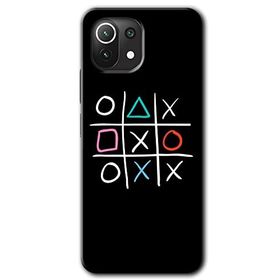 Xiaomi Mi 11 Lite Hd Desen Baskılı Sauce Arka Kapak Kılıf
