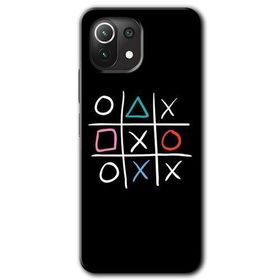 Xiaomi Mi 11 Lite Hd Desen Baskılı Sauce Arka Kapak Kılıf