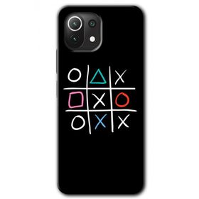 Xiaomi Mi 11 Lite Hd Desen Baskılı Sauce Arka Kapak Kılıf