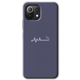 Xiaomi Mi 11 Lite Hd Desen Baskılı Sigara Zararlıdır Arka Kapak Kılıf