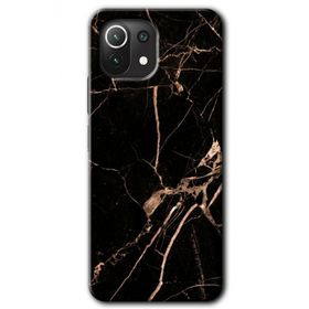 Xiaomi Mi 11 Lite Hd Desen Baskılı Siyah Gold Mermer Arka Kapak Kılıf
