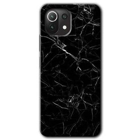 Xiaomi Mi 11 Lite Hd Desen Baskılı Siyah Mermer Arka Kapak Kılıf