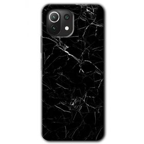 Xiaomi Mi 11 Lite Hd Desen Baskılı Siyah Mermer Arka Kapak Kılıf