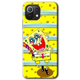 Xiaomi Mi 11 Lite Hd Desen Baskılı Siyah Mermer Desenli Y Harfi Arka Kapak Kılıf