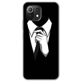 Xiaomi Mi 11 Lite Hd Desen Baskılı Smokin Arka Kapak Kılıf