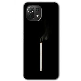 Xiaomi Mi 11 Lite Hd Desen Baskılı Sönmüş Kibrit Arka Kapak Kılıf