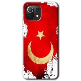 Xiaomi Mi 11 Lite Hd Desen Baskılı Türkiyem Arka Kapak Kılıf
