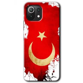 Xiaomi Mi 11 Lite Hd Desen Baskılı Türkiyem Arka Kapak Kılıf