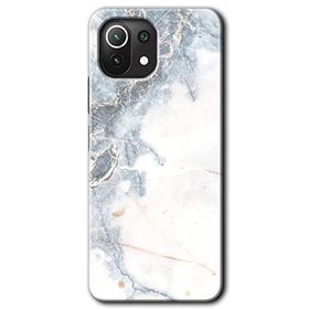 Xiaomi Mi 11 Lite Hd Desen Baskılı White Marble Arka Kapak Kılıf