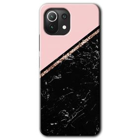 Xiaomi Mi 11 Lite Hd Desen Baskılı Yarım Mermer Arka Kapak Kılıf