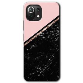 Xiaomi Mi 11 Lite Hd Desen Baskılı Yarım Mermer Arka Kapak Kılıf
