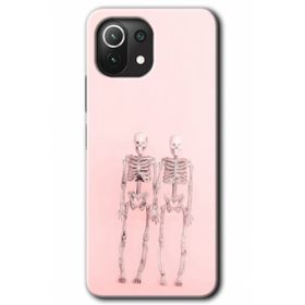 Xiaomi Mi 11 Lite Hd Desen Baskılı Yaşayan Çift Arka Kapak Kılıf