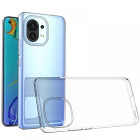Xiaomi Mi 11 Lüx Şeffaf Silikon Cep Telefonu Kılıfı