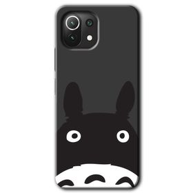 Xiaomi Mi 11 Şaşkın Eşek Baskılı Uyumlu Silikon Kılıf