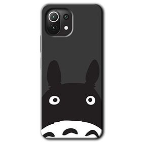 Xiaomi Mi 11 Şaşkın Eşek Baskılı Uyumlu Silikon Kılıf