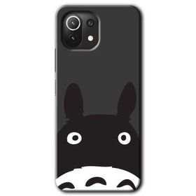 Xiaomi Mi 11 Şaşkın Eşek Baskılı Uyumlu Silikon Kılıf