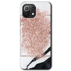 Xiaomi Mi 11 Simli Mermer Baskılı Uyumlu Silikon Kılıf