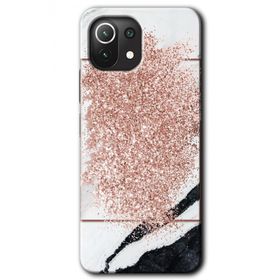 Xiaomi Mi 11 Simli Mermer Baskılı Uyumlu Silikon Kılıf