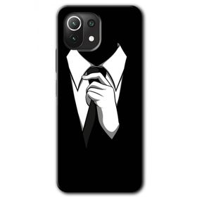 Xiaomi Mi 11 Smokin Baskılı Uyumlu Silikon Kılıf