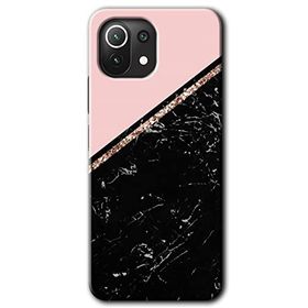 Xiaomi Mi 11 Yarım Mermer Baskılı Uyumlu Silikon Kılıf