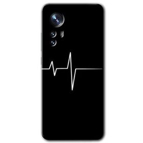 Xiaomi Mi 12 Pro Heart Rytm Baskılı Uyumlu Silikon Kılıf