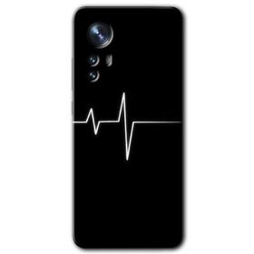 Xiaomi Mi 12 Pro Heart Rytm Baskılı Uyumlu Silikon Kılıf