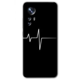 Xiaomi Mi 12 Pro Heart Rytm Baskılı Uyumlu Silikon Kılıf