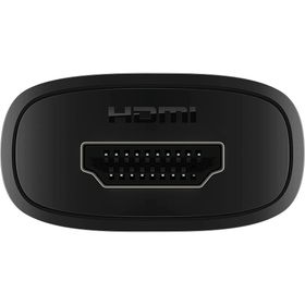Xiaomi Mi TV Stick Android TV Medya Oynatıcı