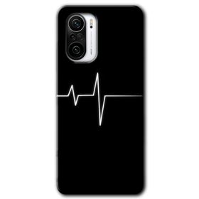 Xiaomi Redmi K40 Heart Rytm Baskılı Uyumlu Silikon Kılıf