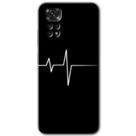 Xiaomi Redmi Note 11 5G Global Heart Rytm Baskılı Uyumlu Silikon Kılıf