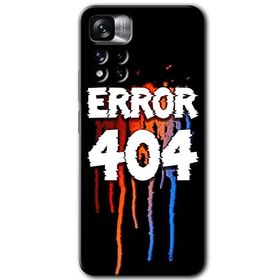 Xiaomi Redmi Note 11 Pro Plus 5G 404 Error Baskılı Uyumlu Silikon Kılıf