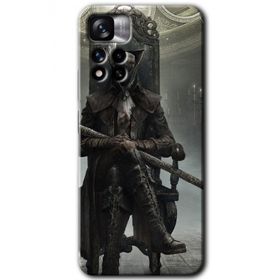 Xiaomi Redmi Note 11 Pro Plus 5G Bloodborne Hunters Baskılı Uyumlu Silikon Kılıf