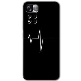 Xiaomi Redmi Note 11 Pro Plus 5G Heart Rytm Baskılı Uyumlu Silikon Kılıf