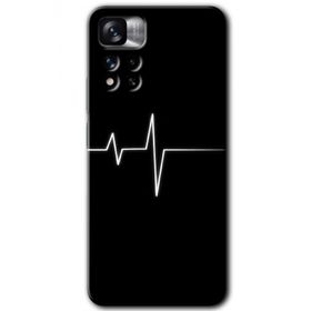 Xiaomi Redmi Note 11 Pro Plus 5G Heart Rytm Baskılı Uyumlu Silikon Kılıf